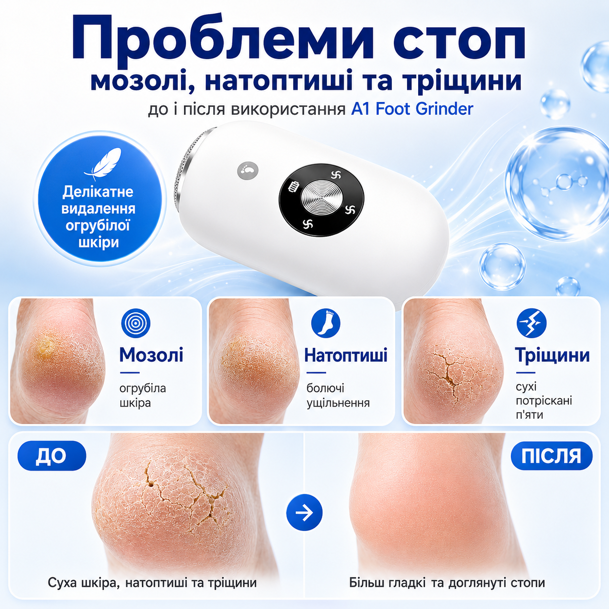 Проблеми стоп: мозолі, натоптиші та тріщини до і після використання A1 Foot Grinder